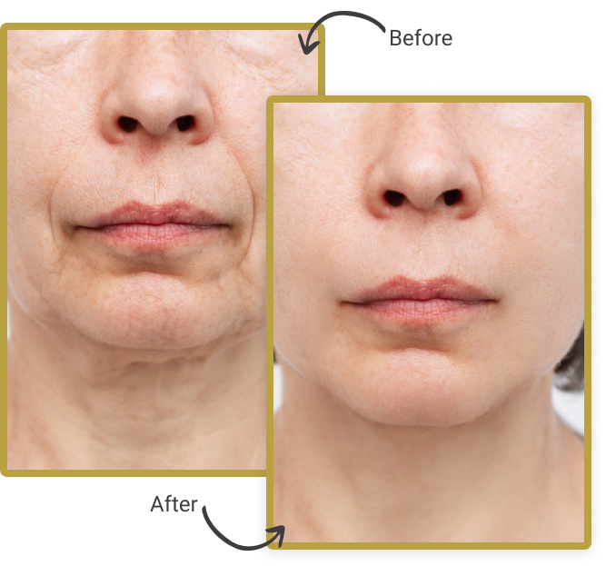 SKIN REJUVENATION AND BODY CONTOURING