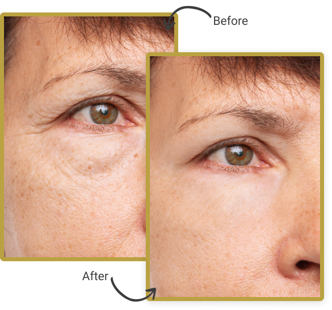 SKIN REJUVENATION AND BODY CONTOURING