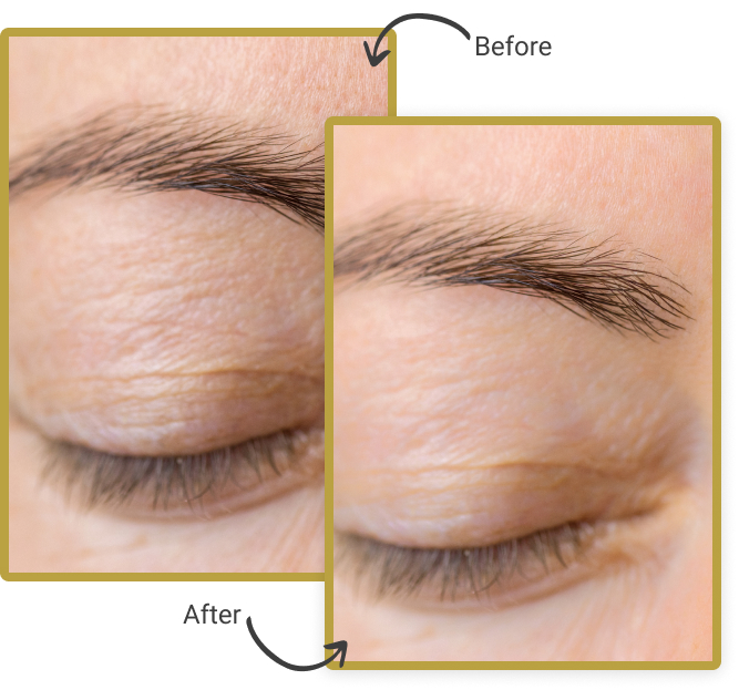 SKIN REJUVENATION AND BODY CONTOURING