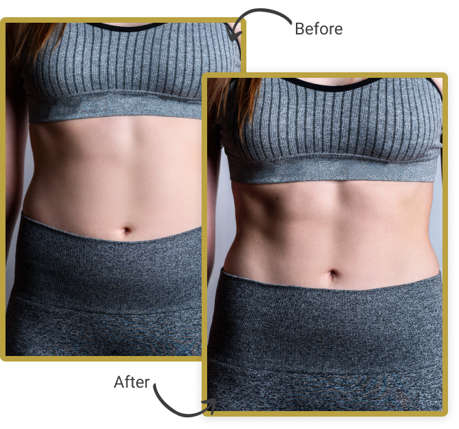 SKIN REJUVENATION AND BODY CONTOURING
